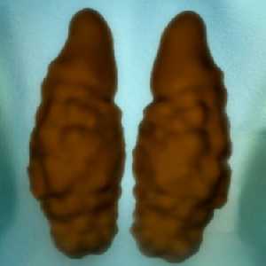 hermaphrodite hermaphrodite