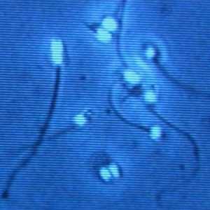 semen quality semen quality